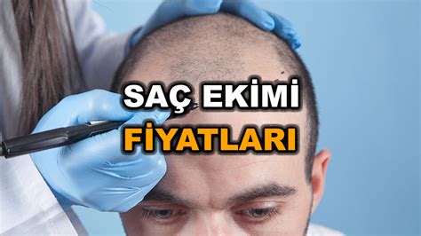 1000 Greft Saç Ekimi Fiyatı: Neler Dahil?