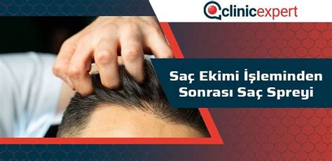 Saç Ekimi: Temel Bilgiler