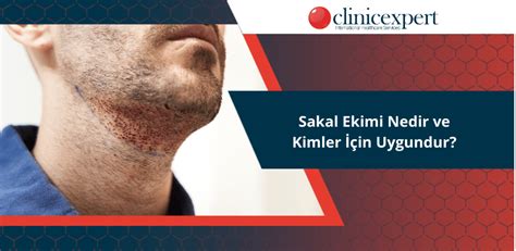 Sakal ekimi kimlere uygundur?