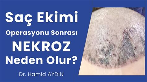 Sakal Ekimi Operasyonu Öncesinde Hazırlık Aşamaları