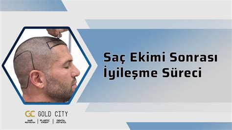 Sakal Ekimi Sonrası İyileşme Süreci