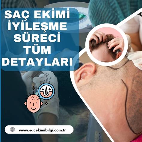 Saç Ekimi ve Meditasyon: İyileşme Sürecine Katkıları